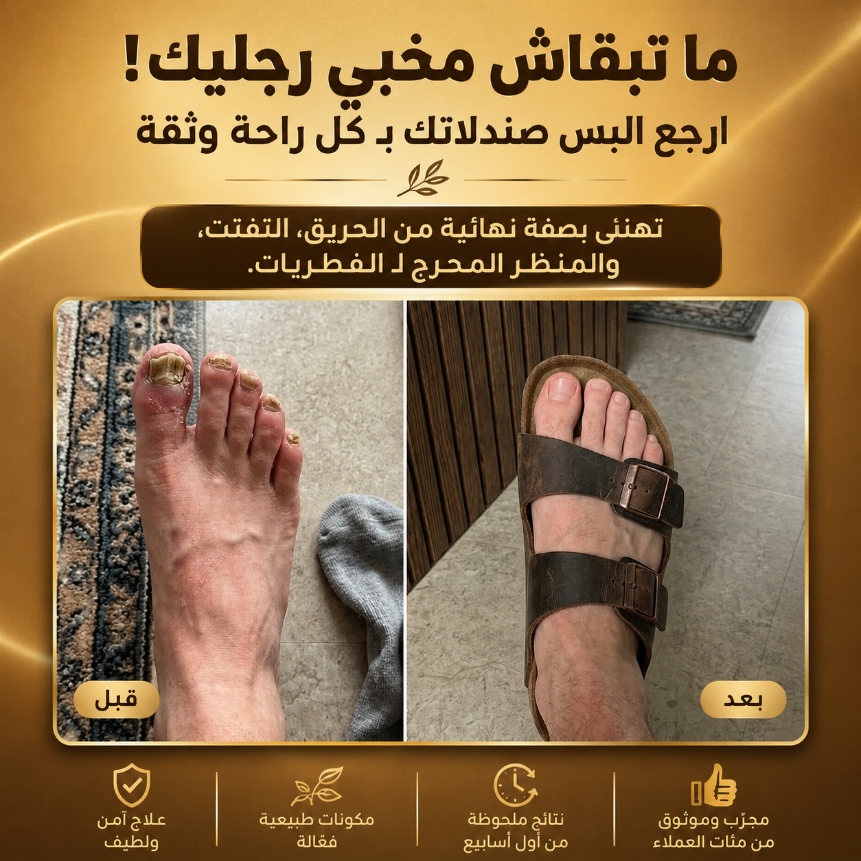 زيت مرجانة الطبيعي لعلاج فطريات الأظافر واسترجاع لونها الصحي