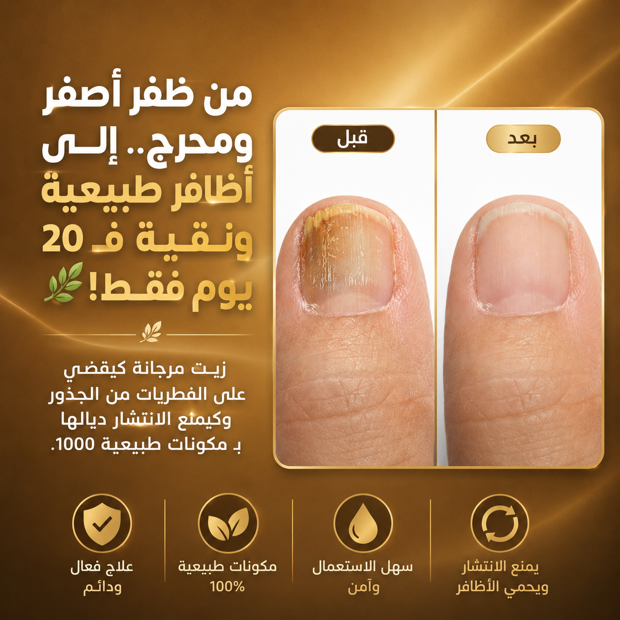 زيت مرجانة الطبيعي لعلاج فطريات الأظافر واسترجاع لونها الصحي
