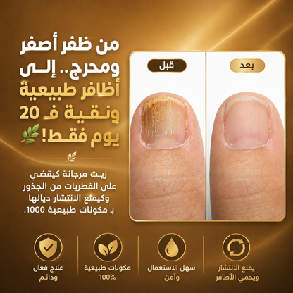 زيت مرجانة الطبيعي لعلاج فطريات الأظافر واسترجاع لونها الصحي